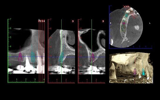 Radiologie numérique 2D et 3D